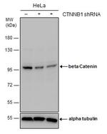 beta Catenin Antibody in Western Blot (WB)