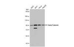 beta Catenin Antibody in Western Blot (WB)