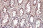 Galectin 3 Antibody in Immunohistochemistry (Paraffin) (IHC (P))