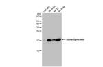 alpha Synuclein Antibody in Western Blot (WB)