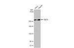 TET1 Antibody in Western Blot (WB)