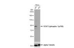 Phospho-STAT3 (Tyr705) Antibody in Western Blot (WB)