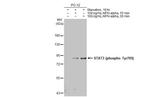 Phospho-STAT3 (Tyr705) Antibody in Western Blot (WB)