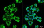 MC1R Antibody in Immunocytochemistry (ICC/IF)