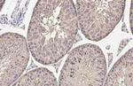 MC1R Antibody in Immunohistochemistry (Paraffin) (IHC (P))