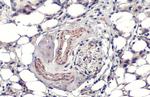 SOD2 Antibody in Immunohistochemistry (Paraffin) (IHC (P))