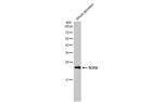 SOD2 Antibody in Western Blot (WB)