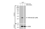 SOD2 Antibody in Western Blot (WB)