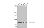 alpha Actinin 2 Antibody in Western Blot (WB)