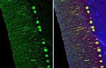 Calbindin/Calretinin Antibody in Immunohistochemistry (Paraffin) (IHC (P))