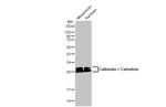 Calbindin/Calretinin Antibody in Western Blot (WB)