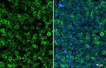 IBA1 Antibody in Immunocytochemistry (ICC/IF)