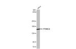 YTHDC2 Antibody in Western Blot (WB)