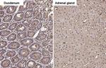 GNAI3 Antibody in Immunohistochemistry (Paraffin) (IHC (P))