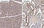 NDUFS3 Antibody in Immunohistochemistry (Paraffin) (IHC (P))