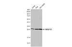 NDUFS3 Antibody in Western Blot (WB)