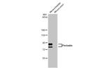 Periostin Antibody in Western Blot (WB)