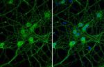 PIN1 Antibody in Immunocytochemistry (ICC/IF)