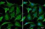 Annexin A1 Antibody in Immunocytochemistry (ICC/IF)