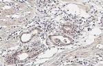 CYR61 Antibody in Immunohistochemistry (Paraffin) (IHC (P))