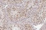 POLE Antibody in Immunohistochemistry (Paraffin) (IHC (P))