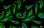 FASN Antibody in Immunocytochemistry (ICC/IF)