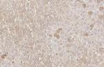 FASN Antibody in Immunohistochemistry (Paraffin) (IHC (P))