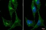 ARL13B Antibody in Immunocytochemistry (ICC/IF)