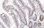 CXCR7 Antibody in Immunohistochemistry (Paraffin) (IHC (P))