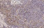 PFKFB4 Antibody in Immunohistochemistry (Paraffin) (IHC (P))