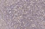 PFKFB4 Antibody in Immunohistochemistry (Paraffin) (IHC (P))