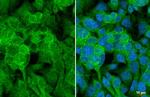 Angiogenin Antibody in Immunocytochemistry (ICC/IF)