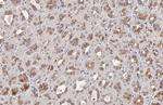 FN3K Antibody in Immunohistochemistry (Paraffin) (IHC (P))