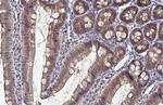 FN3K Antibody in Immunohistochemistry (Paraffin) (IHC (P))