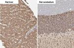 SLC27A2 Antibody in Immunohistochemistry (Paraffin) (IHC (P))