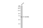 SLC27A2 Antibody in Western Blot (WB)