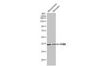 IPMK Antibody in Western Blot (WB)