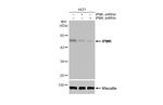 IPMK Antibody in Western Blot (WB)