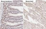 ZEB1 Antibody in Immunohistochemistry (Paraffin) (IHC (P))