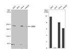 ZEB1 Antibody in Western Blot (WB)