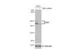 ZEB1 Antibody in Western Blot (WB)