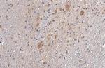 SDHB Antibody in Immunohistochemistry (Paraffin) (IHC (P))