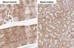 SDHB Antibody in Immunohistochemistry (Paraffin) (IHC (P))