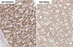 SDHB Antibody in Immunohistochemistry (Paraffin) (IHC (P))