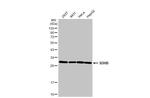 SDHB Antibody in Western Blot (WB)