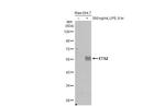 ETS2 Antibody in Western Blot (WB)