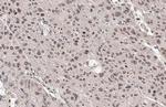 ARID1A Antibody in Immunohistochemistry (Paraffin) (IHC (P))