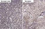 ARID1A Antibody in Immunohistochemistry (Paraffin) (IHC (P))