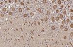 TLR3 Antibody in Immunohistochemistry (Paraffin) (IHC (P))