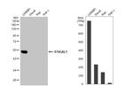 ST6GAL1 Antibody in Western Blot (WB)